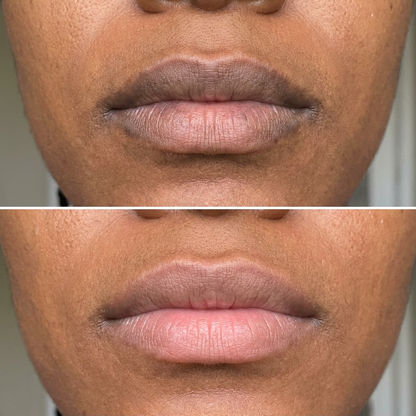 Jenovie™ Lip Brightening Balm