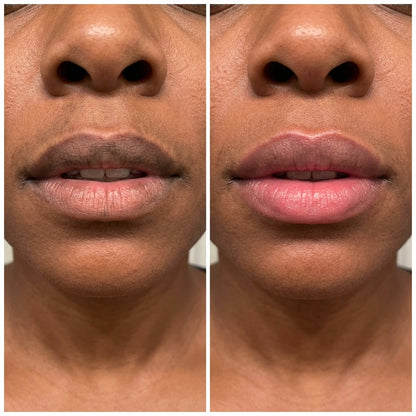 Jenovie™ Lip Brightening Balm