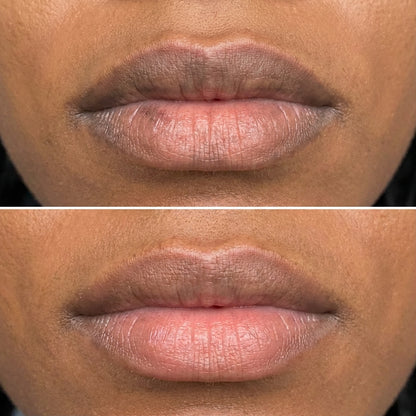 Jenovie™ Lip Brightening Balm